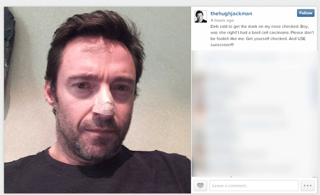 hugh jackman skin cancer