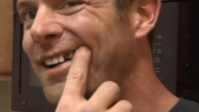 Noah Galloway, Noah Galloway Tooth, Noah Galloway Loses Tooth, Noah Galloway Injury, Noah Galloway Injured, Noah Galloway DWTS, Sharna Burgess Knocks Out Noah Galloway Tooth, Noah Galloway Injuries, Noah Galloway Dancing With The Stars
