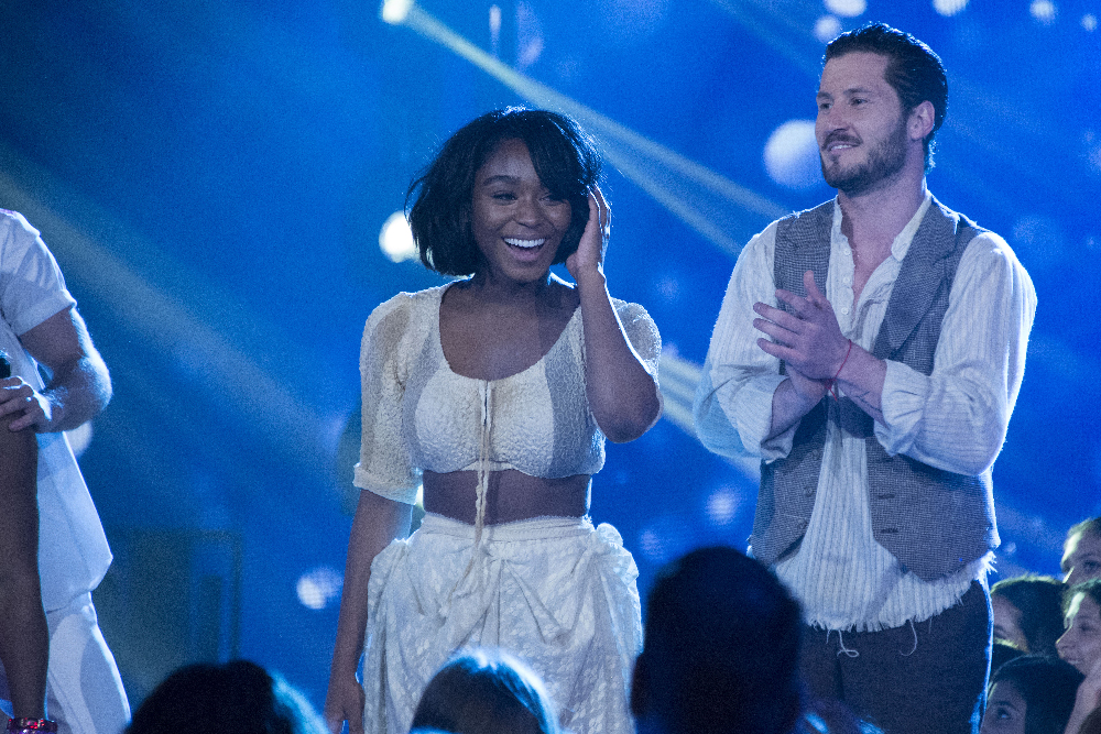 Normani Kordei, Normani Kordei DWTS, Normani Kordei Dancing With The Stars, Normani Kordei Ankle Injury, Normani Kordei Injured