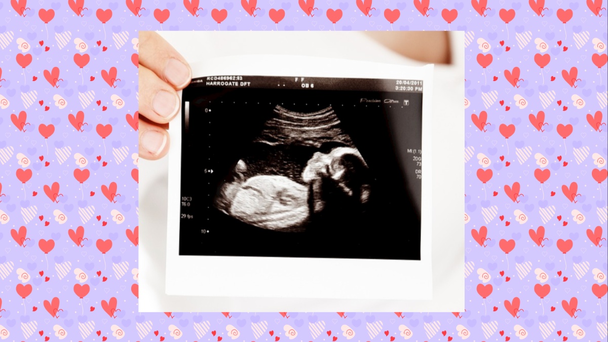 A sonogram.