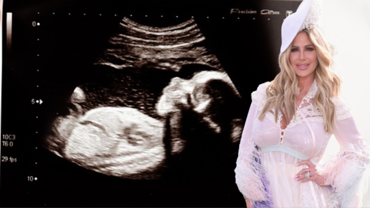 Kim Zolciak-Biermann.