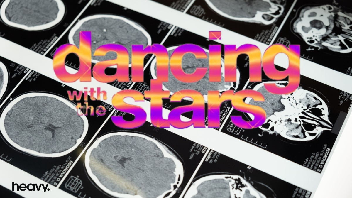 DWTS Brain Scan