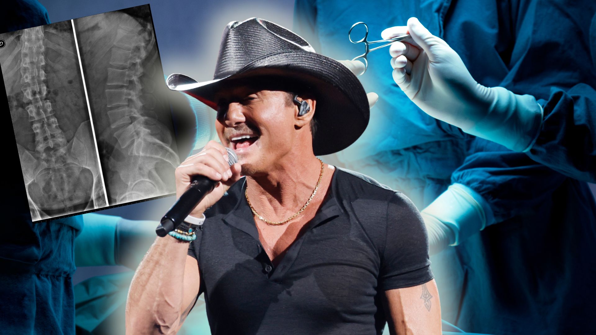 Tim McGraw's Back Surgery Forces Concert Cancellation