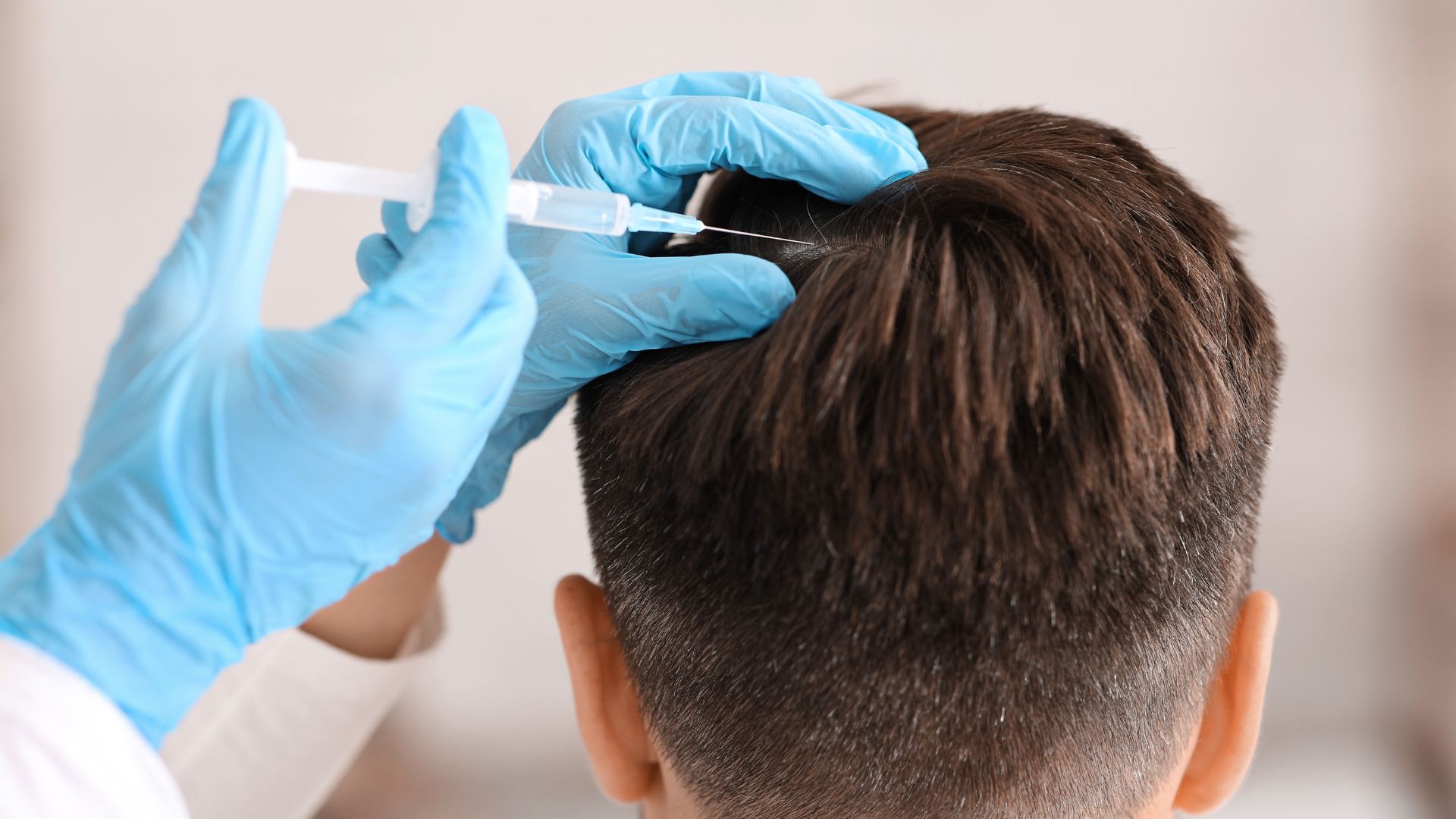 Joel McHale hair transplant
