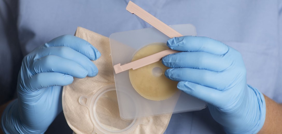 Stomia Co To Jest Jakie Sa Rodzaje Stomii I Jak Wyglada Zycie Po Otosection