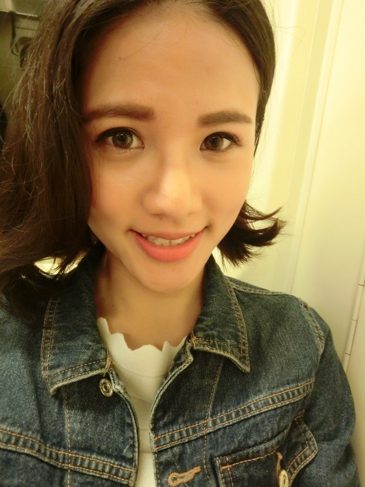 台中醫美/峻美診所-勇敢追夢with卡麥拉隆鼻，重新蛻變自我，找回自信新生感！ 民生資訊分享 醫美 