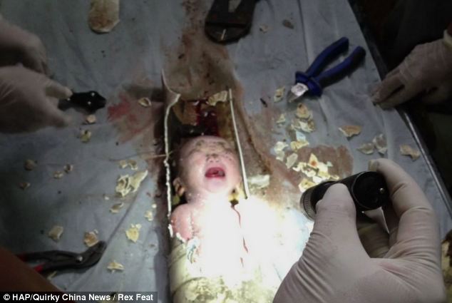 The newborn baby was rescued by firefighters after being flushed down a toilet