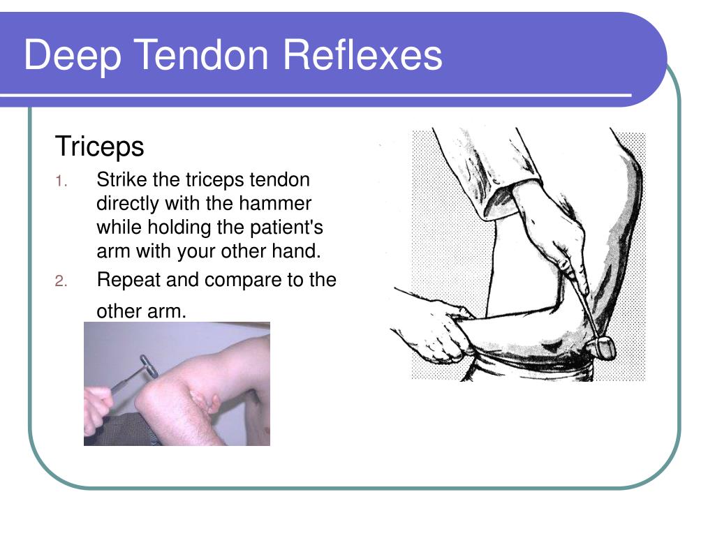 figure-1-from-the-characterization-of-deep-tendon-reflex-of-biceps