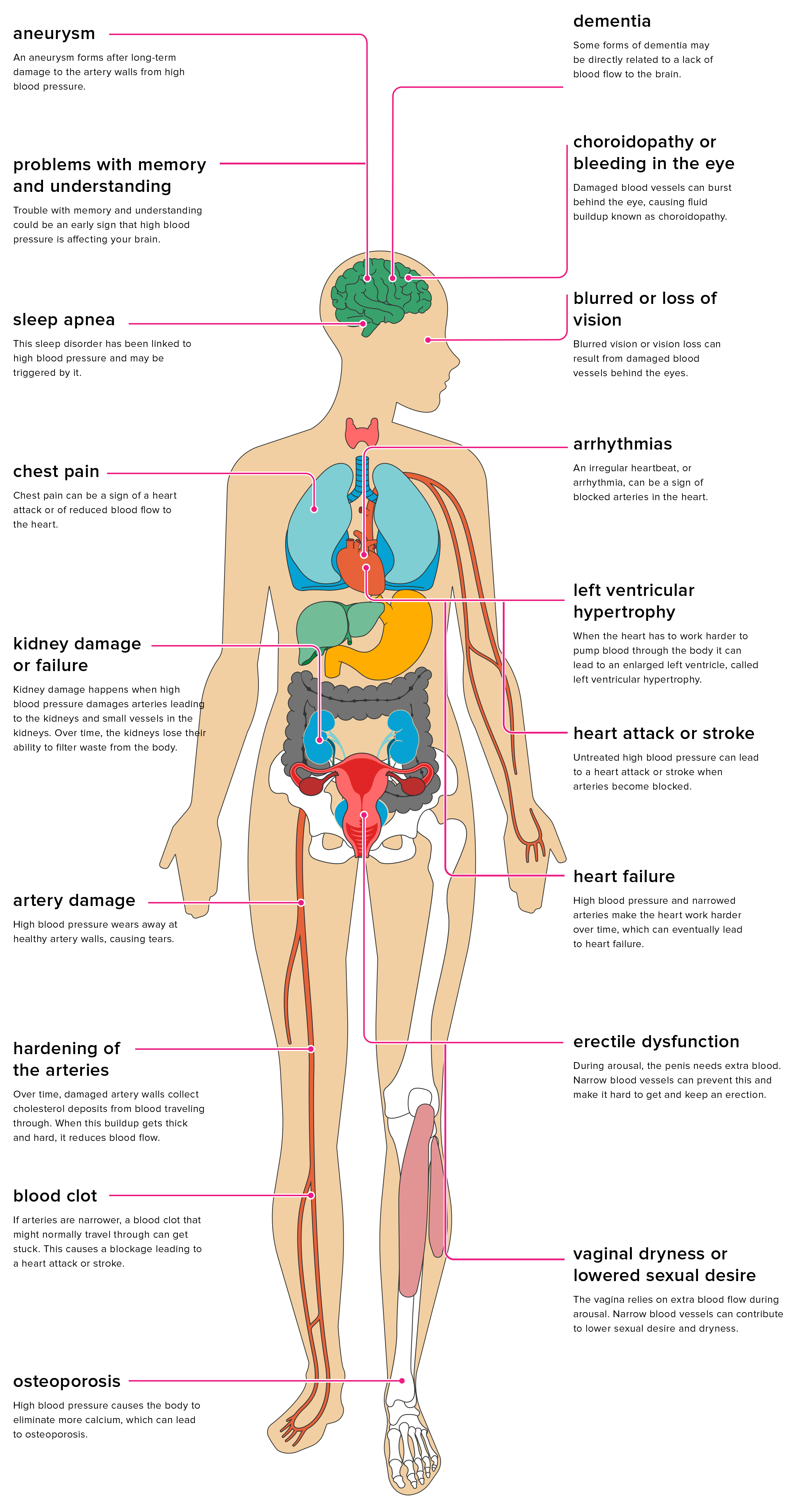 The Effects Of Hypertension On The Body