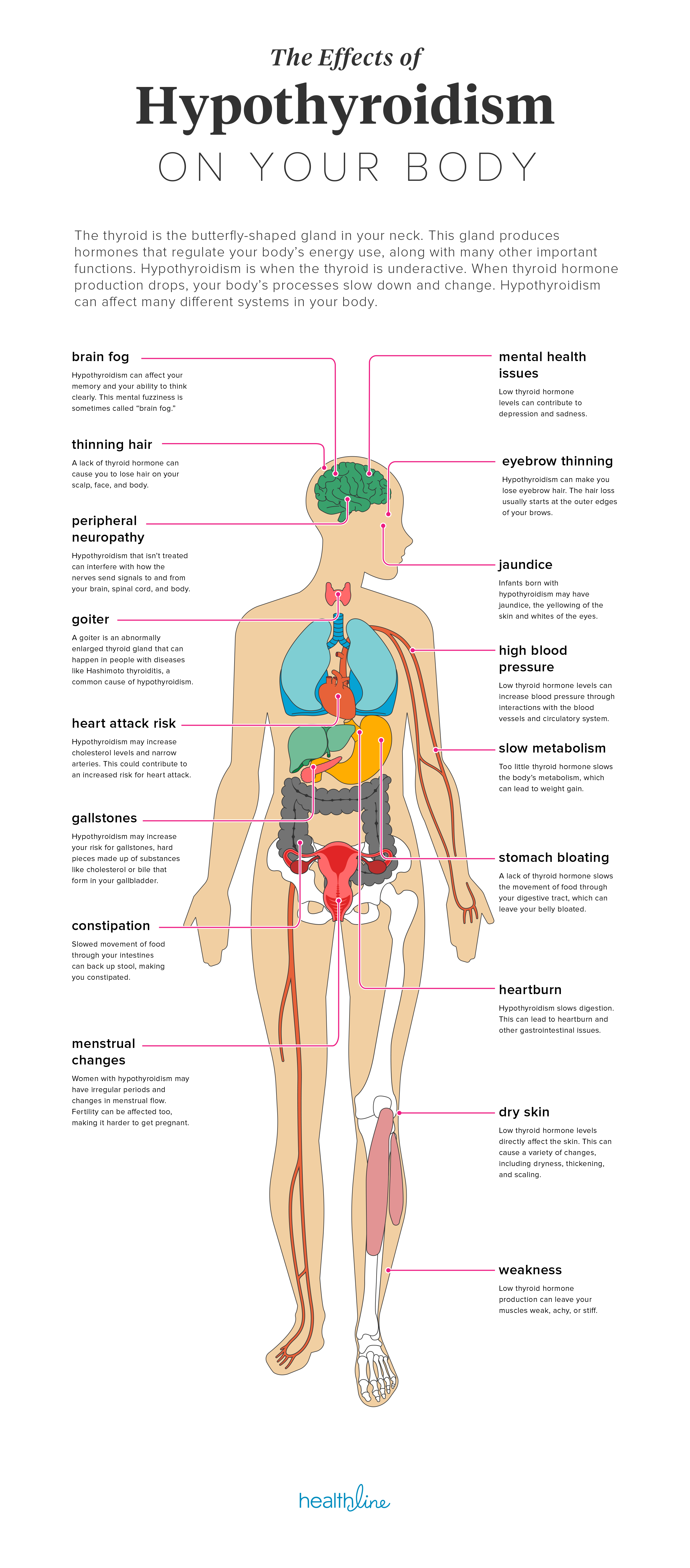 Effects Of Hypothyroidism Thinning Hair Heart Attack And More