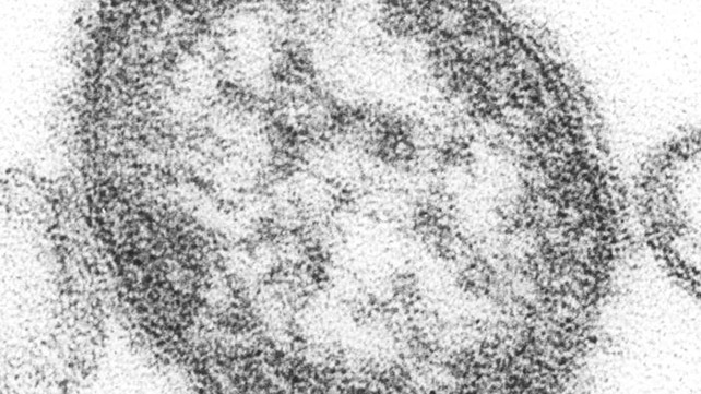 What Does Rubeola Measles Look Like