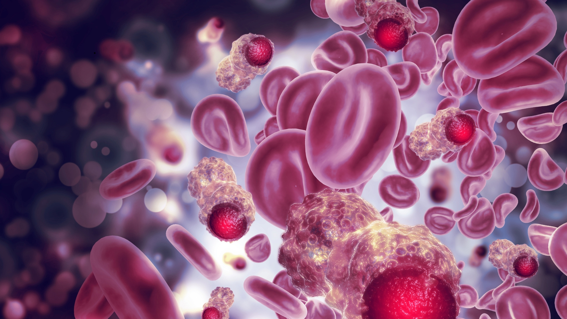 Sickle cell blood cells