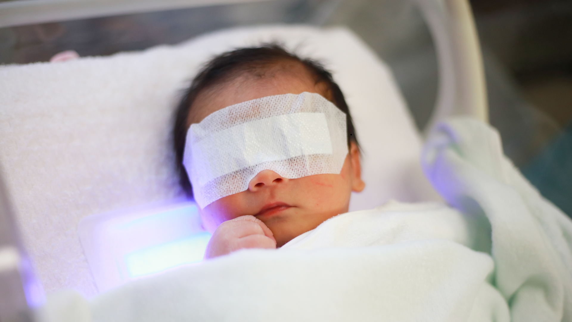A child with jaundice