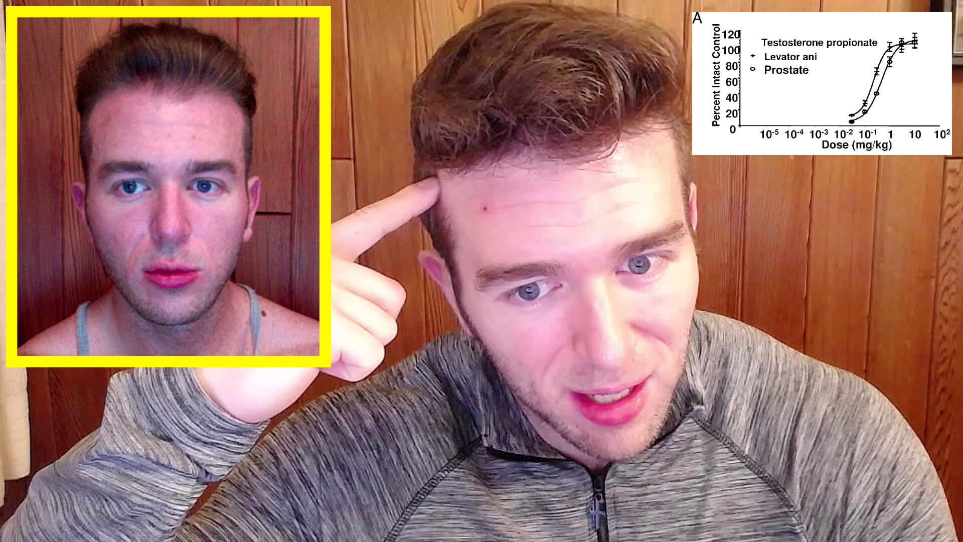 Testosterone Also Causes Hair Loss Not Just Dht Blood Work Proof