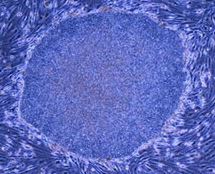 closeup-gendai-ips-yamanaka