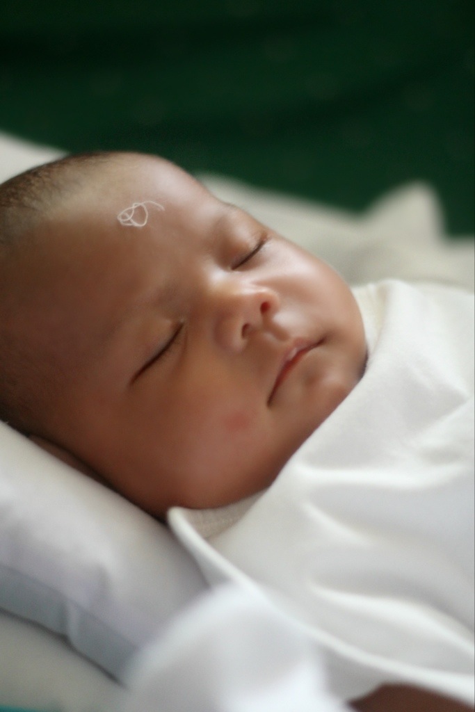 Putting Thread On A Child S Head Does Nothing For Hiccups Dr Olufunmilayo Nigerian Health Blog