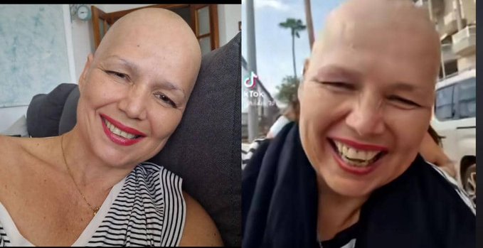 Influencer Hilda Siverio Anuncia Que Le Queda Poco Tiempo De Vida Tras Su Lucha Contra El Cancer