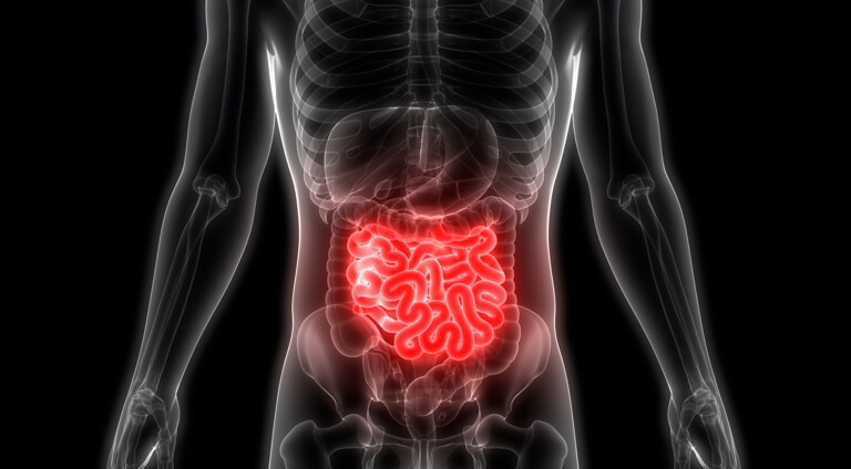 intestines xray