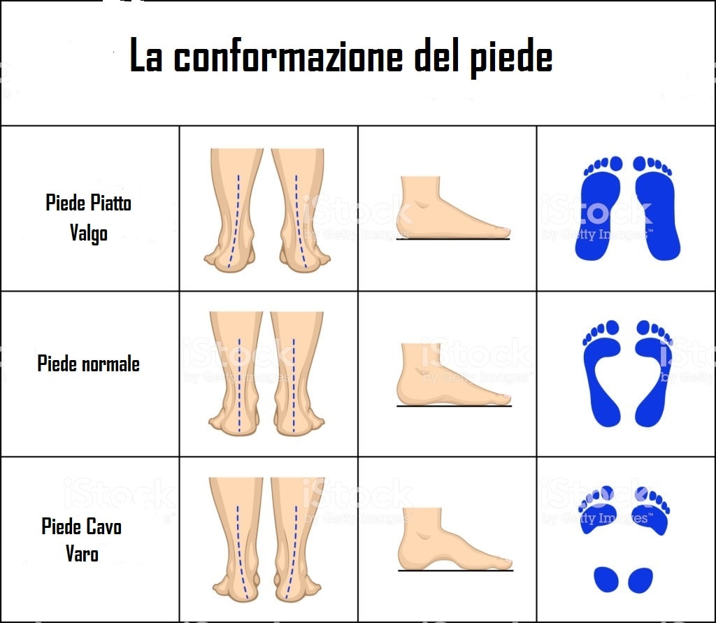 Il Piede Piatto Phisiofit