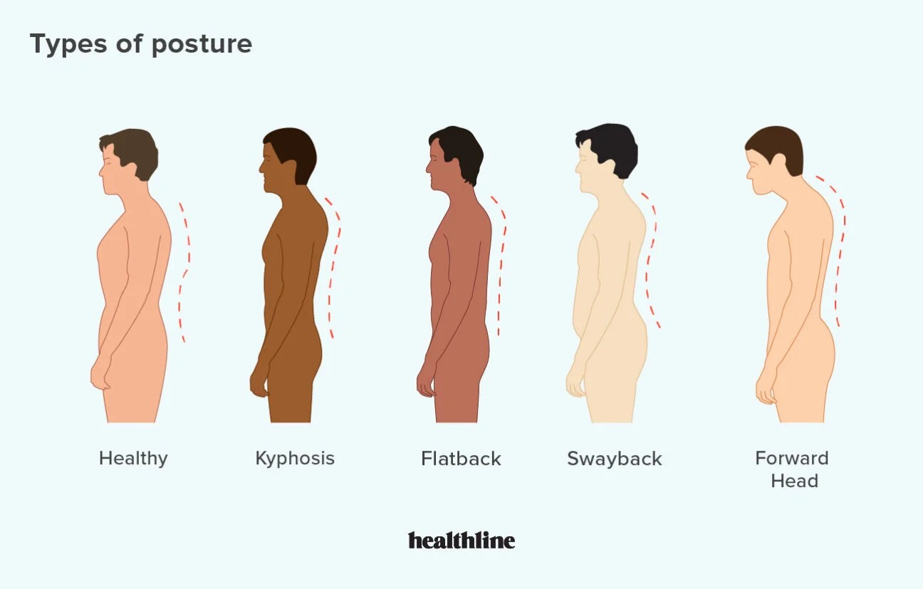 Forward Head Posture Exercises And Stretches To Try