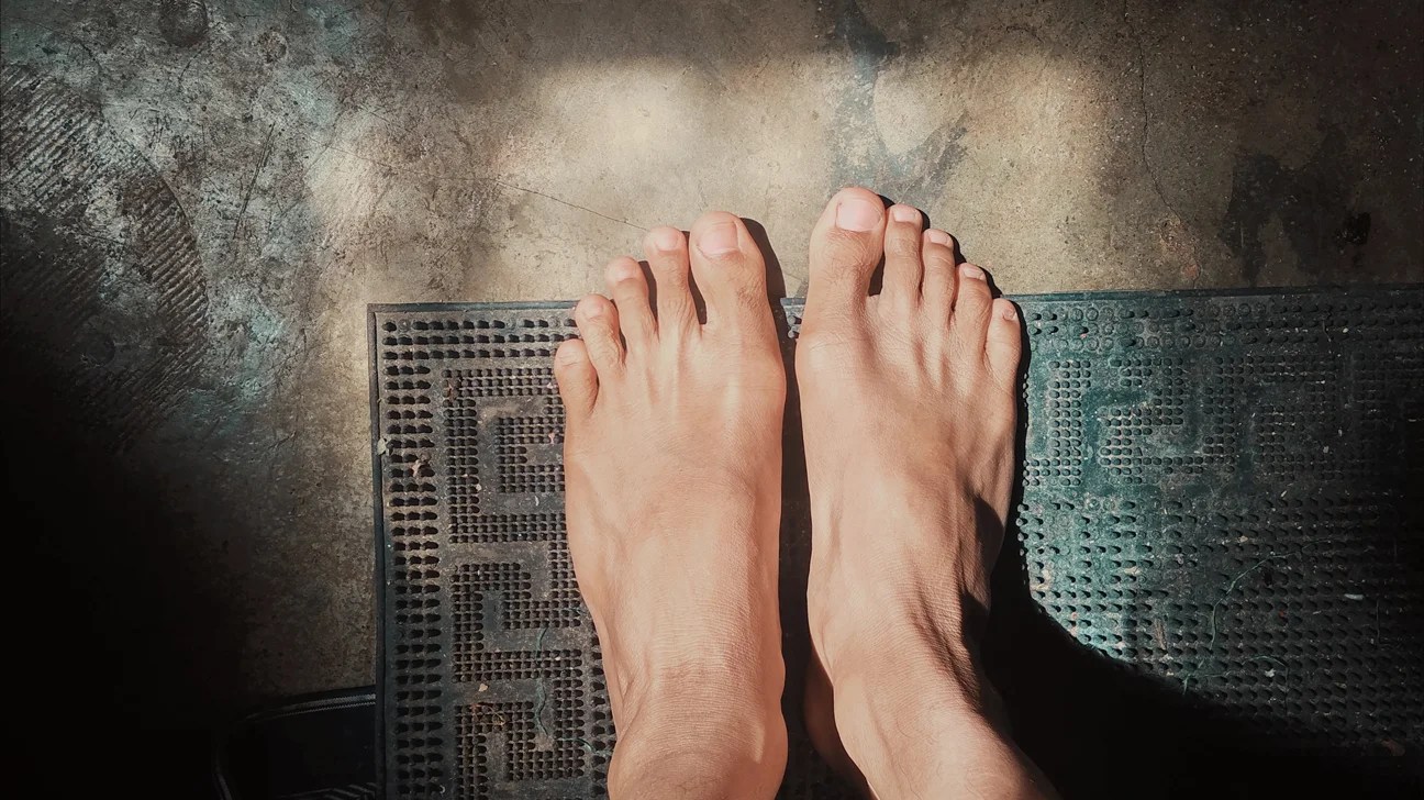 Gout Symptoms Pictures Home Remedies And More