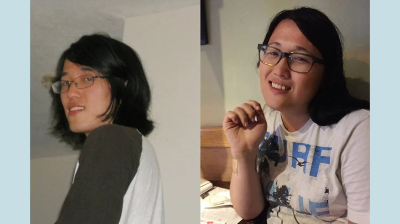 The Effects Of Hrt On Your Skin And Acne