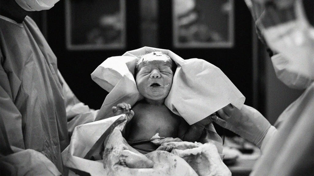 C Section What To Expect And 9 Tips For A Faster Recovery