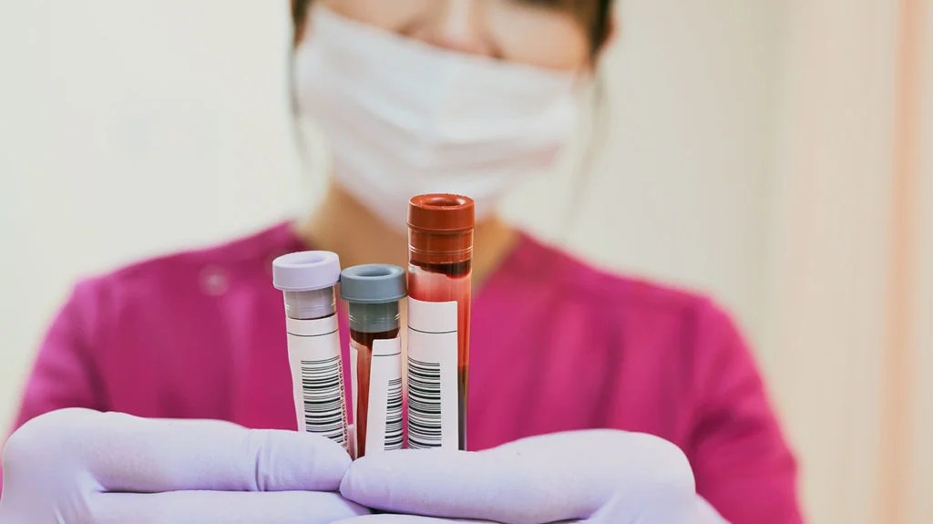 a medical professional holding vials of blood taken during blood tests