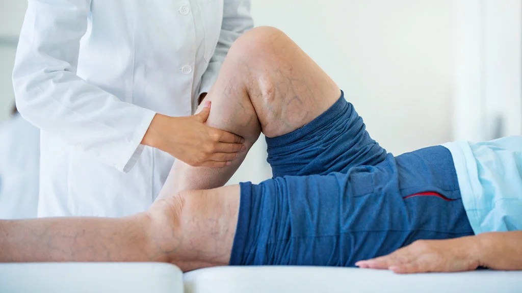 a doctor examining a mans calf for symptoms of deep vein thrombosis