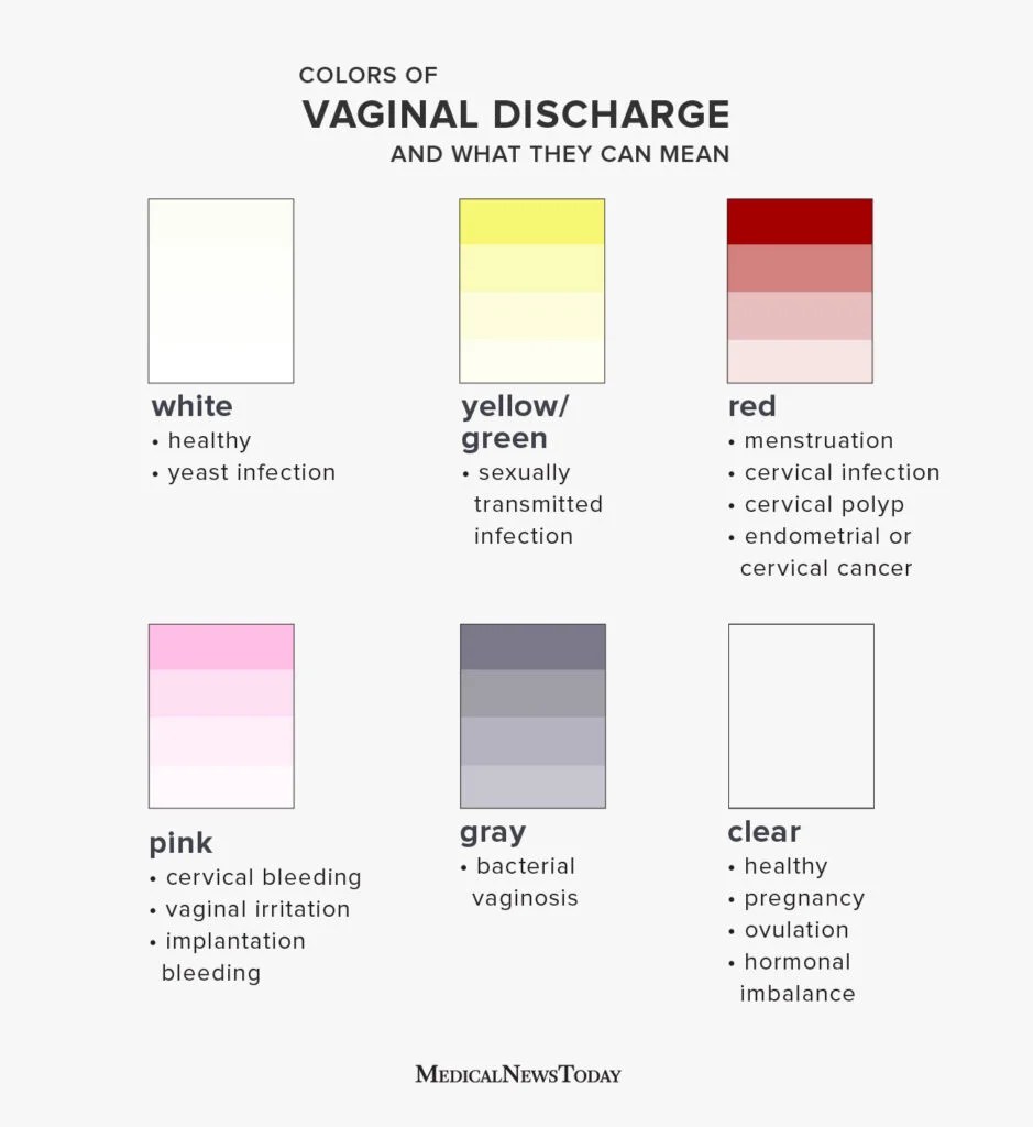 An infographic on thick white discharge.