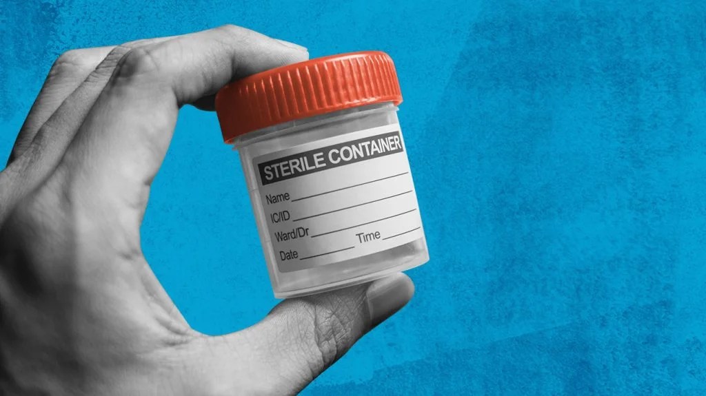 9 Best Home Chlamydia Tests How They Work Reliability And More