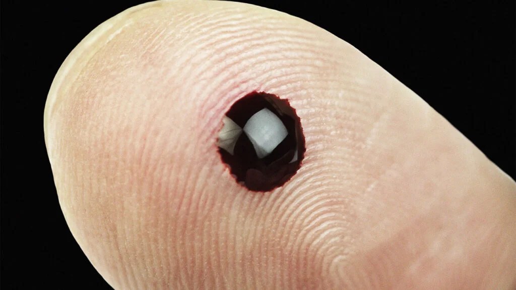 An image of a blood drop on a person's finger.
