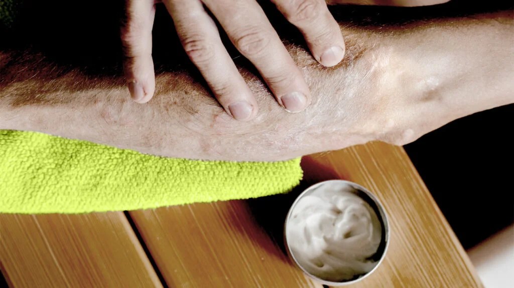 person applying cream to skin
