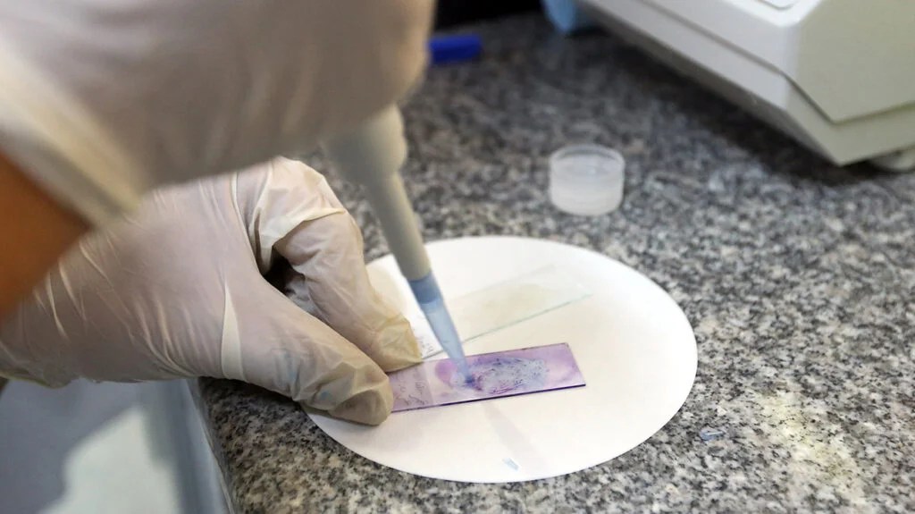 A medical professional examining a biopsy sample in a medical setting