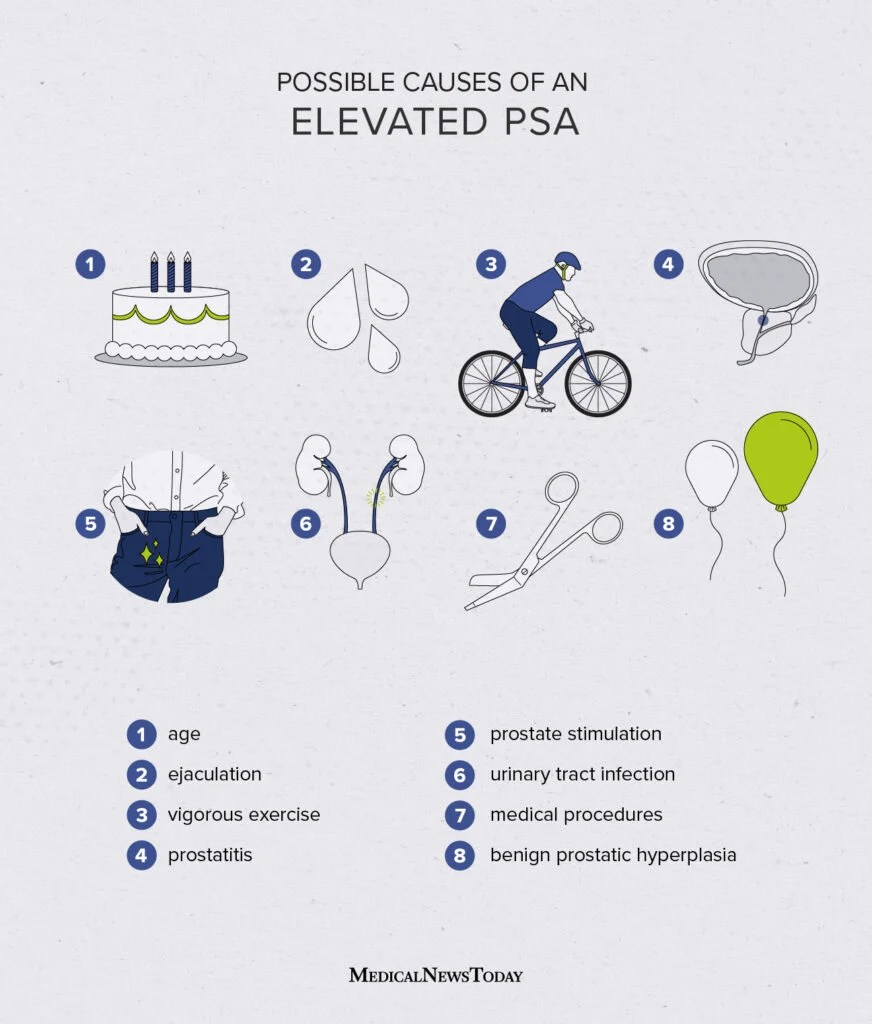 Elevated Psa Noncancerous Causes And Considerations