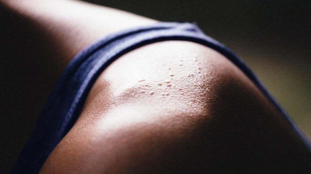 Night Sweats And Alcohol Causes And Treatment