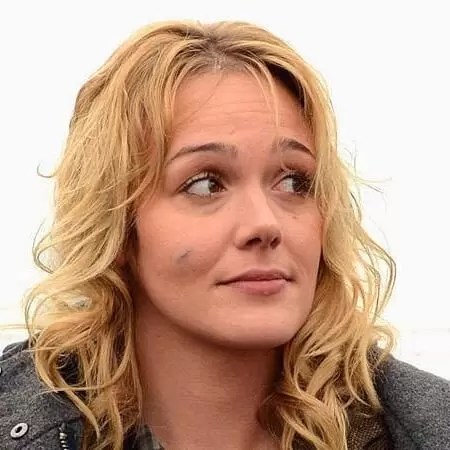 Alwara Hofels Narbe Im Gesicht Promi Medien