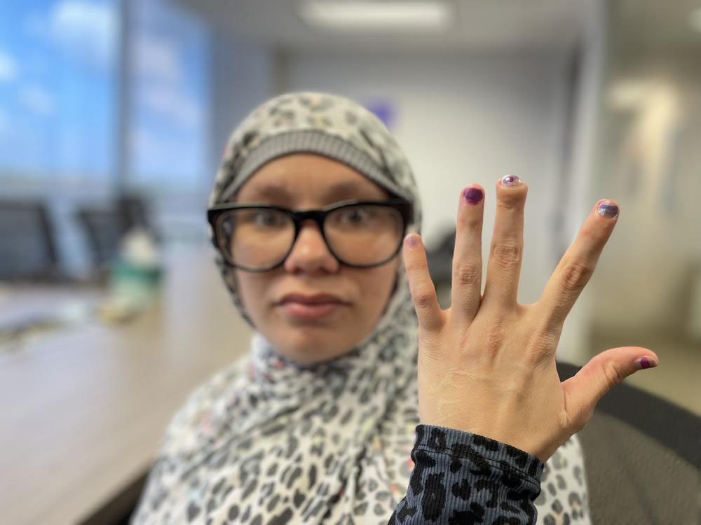 A woman wearing a head scarf and glasses holds up her hand to show her wounded middle finger.