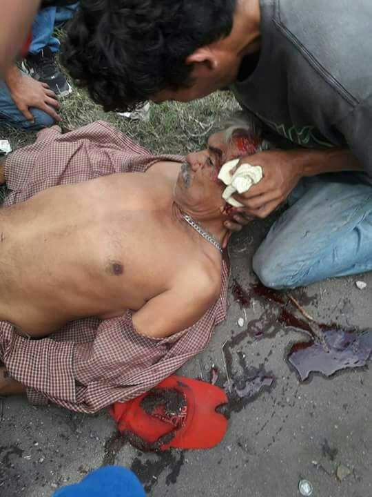 Herido 3