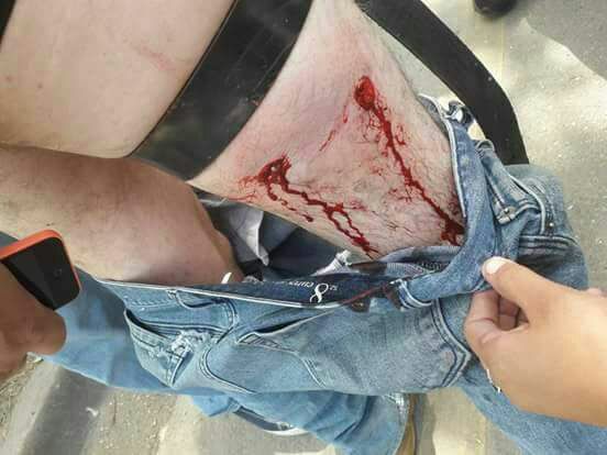 herido 4