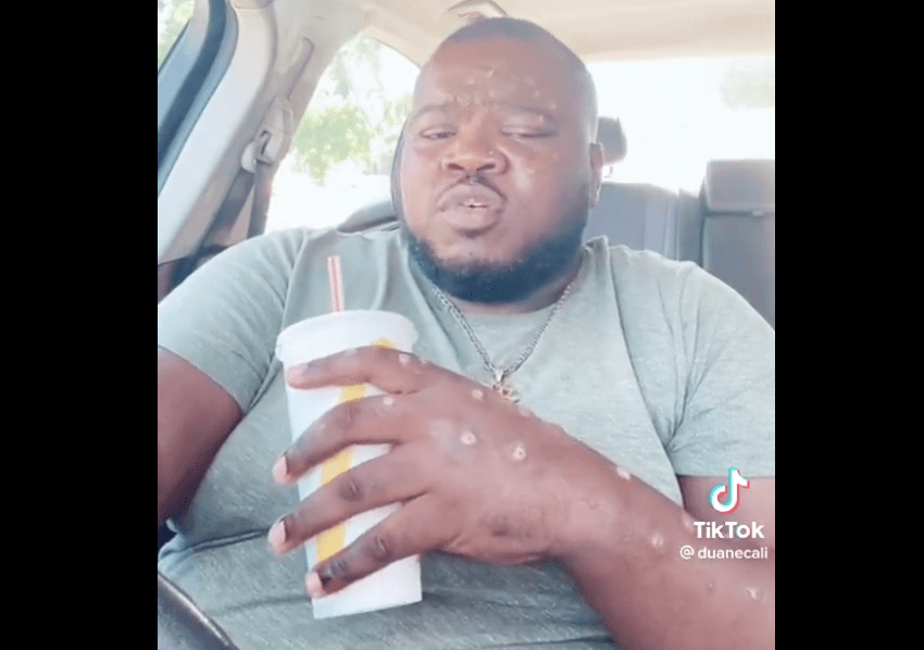 TikToker continue « McDonald’s Run » alors qu’il souffre de monkeypox, Twitter dégoûté