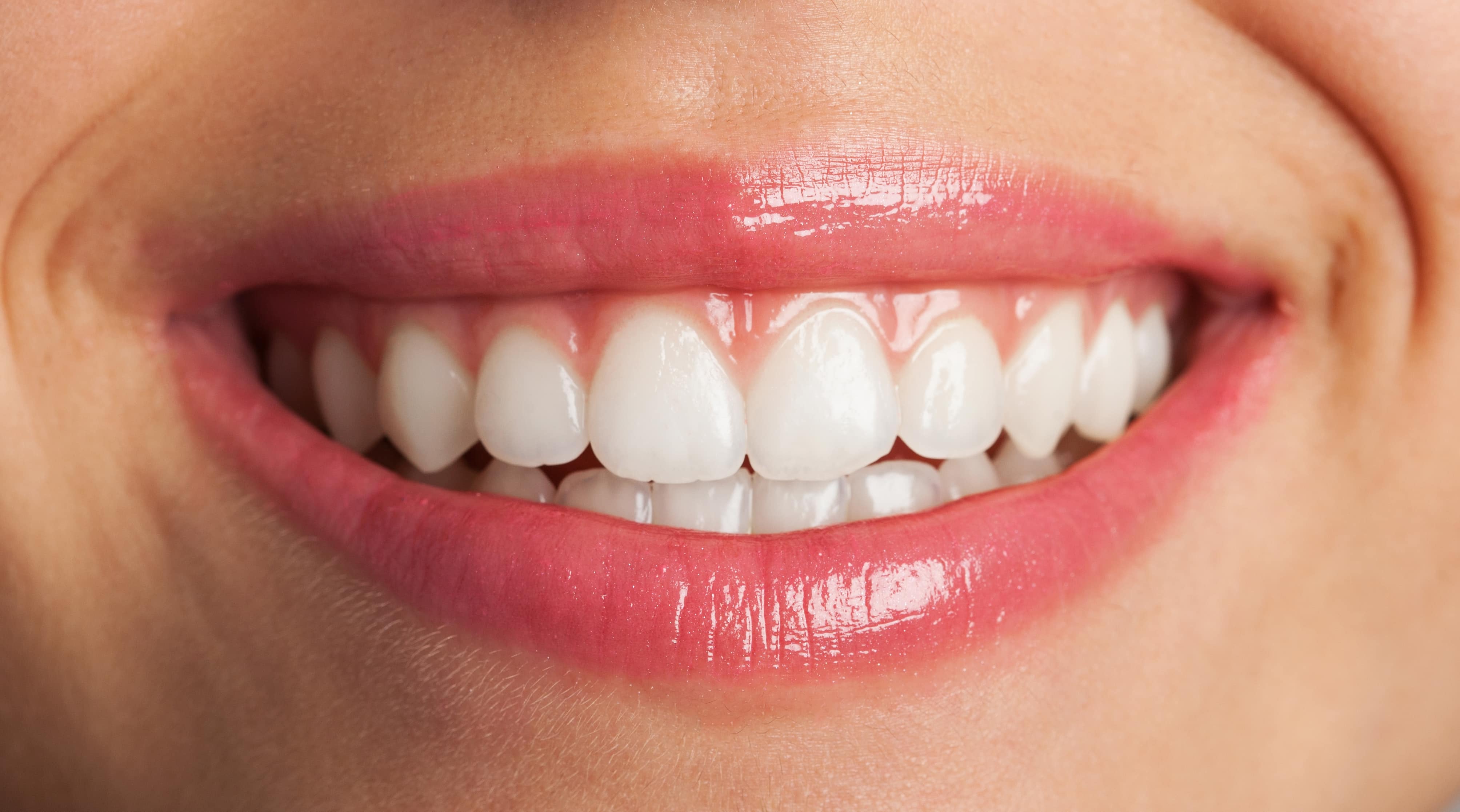 Chipped Tooth Repair Danbury Ct Rolling Hills Dentistry 06810 Dentist