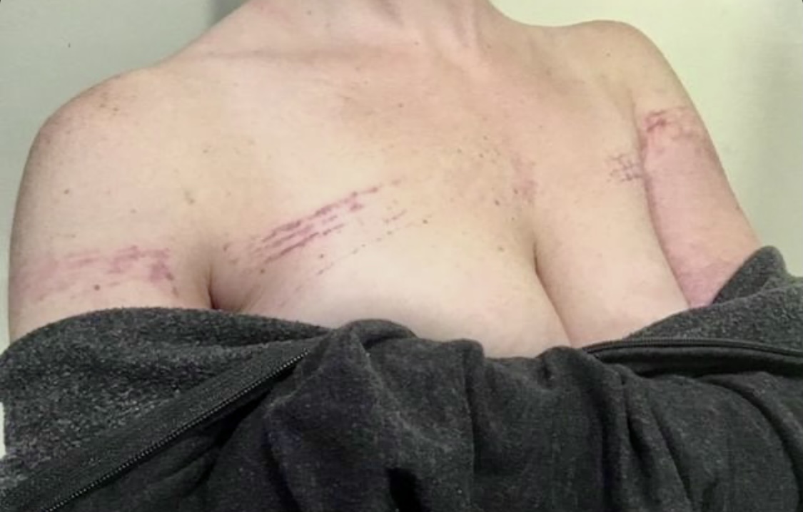 Prevention Response Rope Study