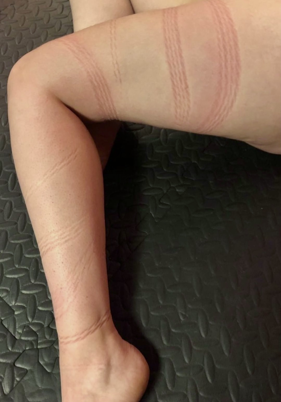 Prevention Response Rope Study