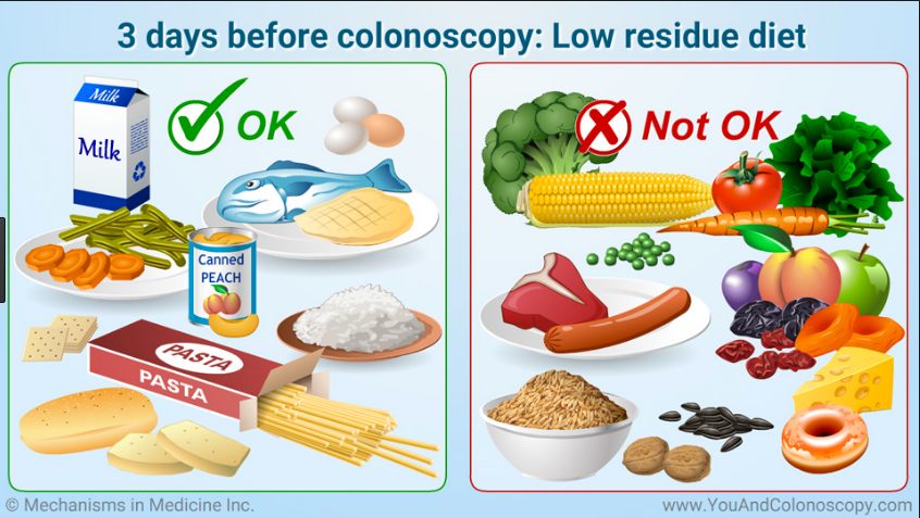 The Dreaded Colonoscopy Shelley Kassian