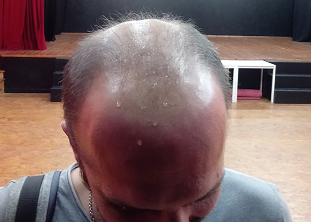 Prevenire La Caduta Dei Capelli Rimedi Naturali Fiori Di Bach