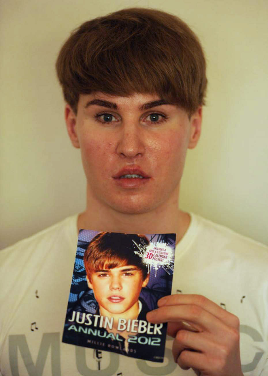 Toby Sheldon gets plastic surgery to look like Justin Bieber