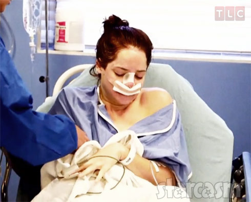 Photos Breaking Amish Model Kate Stoltz Gets A Nose Job Starcasm Net