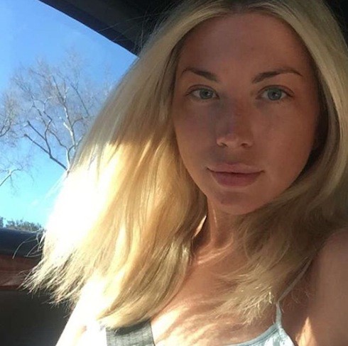 Stassi Schroeder plastic surgery 1