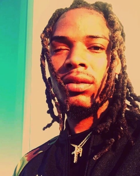 Did Fetty Wap lose both his eyes 1